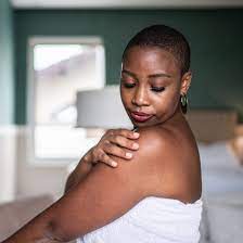 What Is Acne And Who Gets Acne?